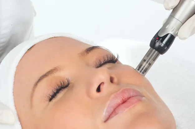 Imagem do Tratamento