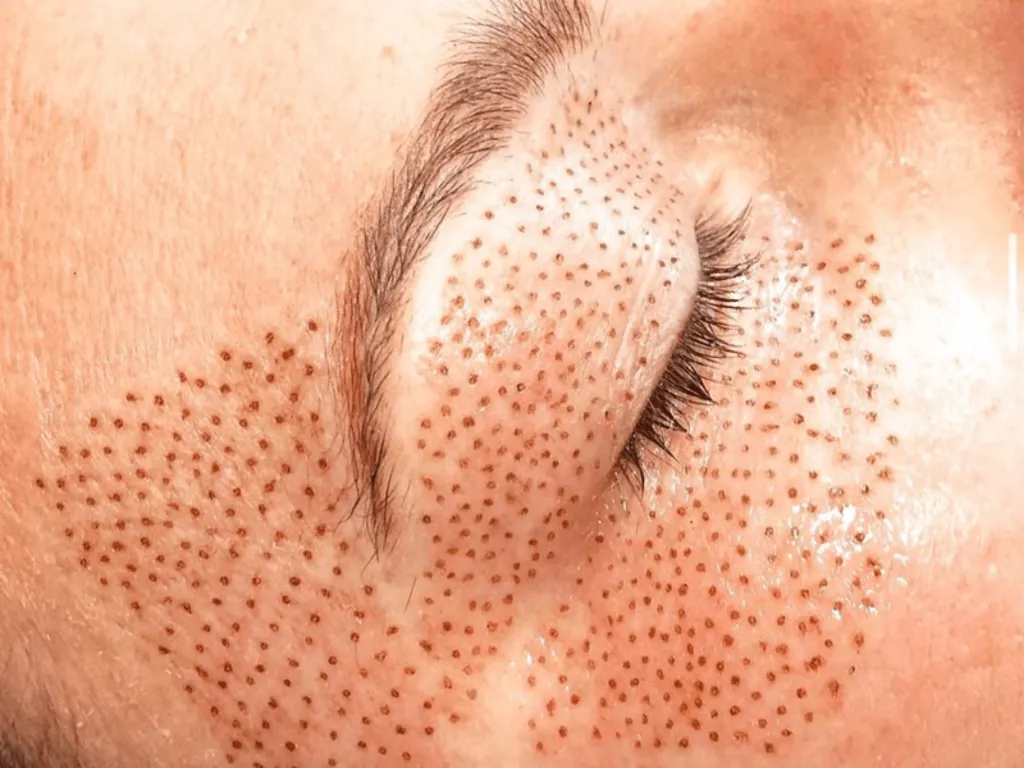 Imagem do Tratamento