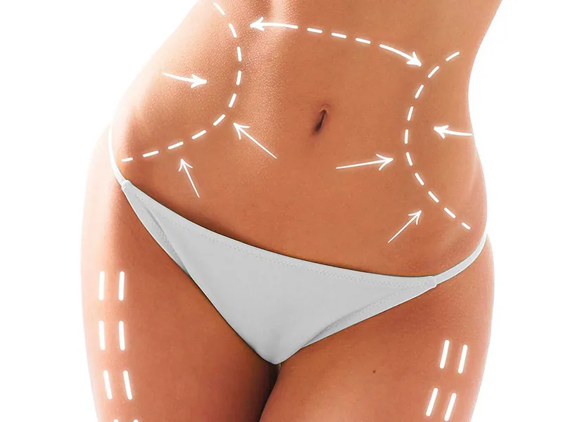 Imagem do Tratamento